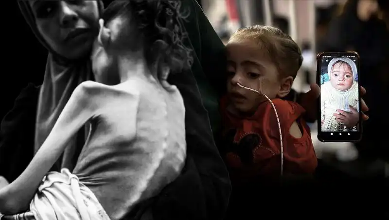 25 Kilo Verip 10 Kilo Düşen Meryem'in Açlıkla Mücadelesi