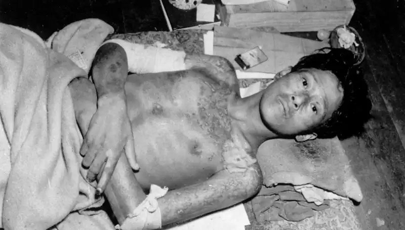 Nagasaki'den Uyanış: Nükleer Tehditin Pençesindeki İnsanlık